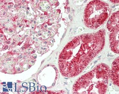 IHC-plus™ MINK1 / MINK Antibody (C-Terminus)