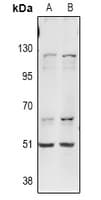 Polyclonal Rabbit anti-Human ITPKA Antibody (IF, WB)