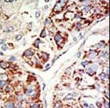 EZH1 / ENX-2 Antibody (aa393-422)