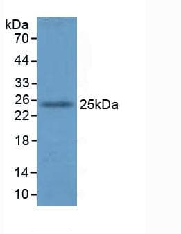GSTA4 Antibody (aa1-222)