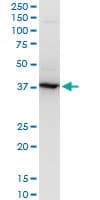 RNF2 / RING2 / RING1B Antibody (clone 2B6)