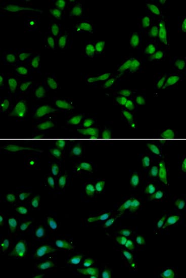 PHAP1 / ANP32A Antibody
