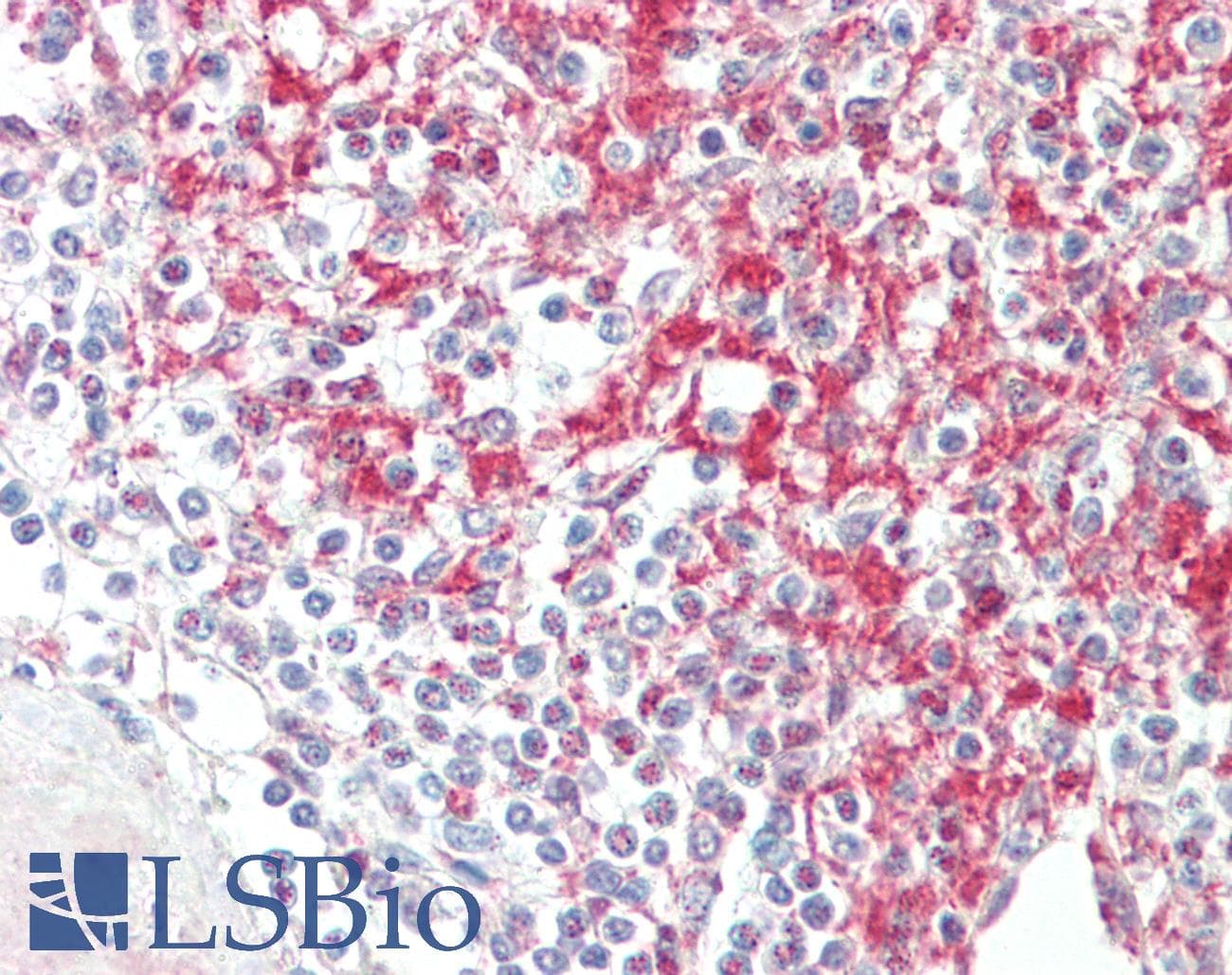 IHC-plus™ ADAM19 Antibody (aa574-588)