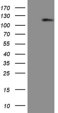 AR / Androgen Receptor Antibody (aa420-659, clone OTI2H2, Carrier-free)