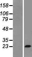 Human GH / Growth Hormone Protein (Over-Expression Lysate Myc-DDK (Flag))