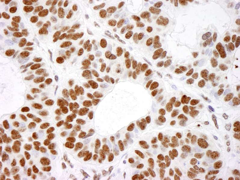 Polyclonal Rabbit anti-Human HIST1H4I Antibody (aa50-C-term, IHC, WB)