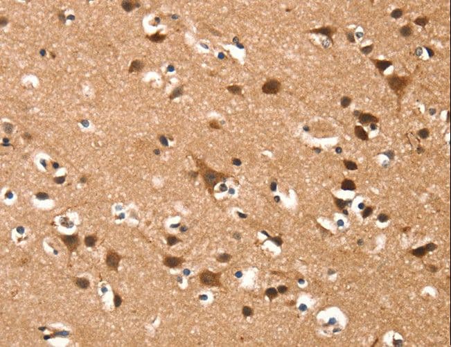 DAAM1 Antibody