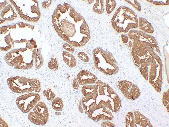 Monoclonal Mouse anti-Human ACPP / PAP Antibody (clone ABT-PSAP, IHC)