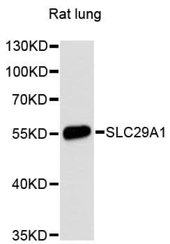 SLC29A1 / ENT1 Antibody