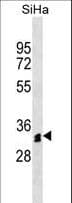 OR51M1 Antibody (aa1-30)