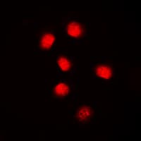 CCNE1 / Cyclin E1 Antibody (C-Terminus)