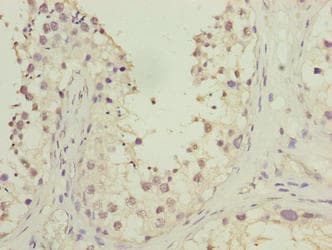 Polyclonal Rabbit anti-Human HOOK1 Antibody (IHC, WB)