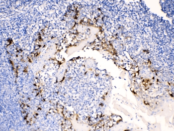 Polyclonal Rabbit anti-Human AGR2 Antibody (IHC, WB)