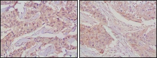 GSK3B / GSK3 Beta Antibody (clone 3D10)