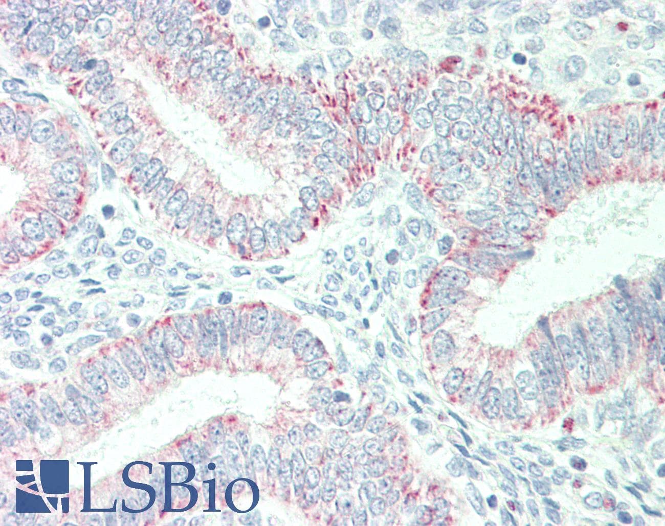 IHC-plus™ PHB / Prohibitin Antibody (aa222-272)