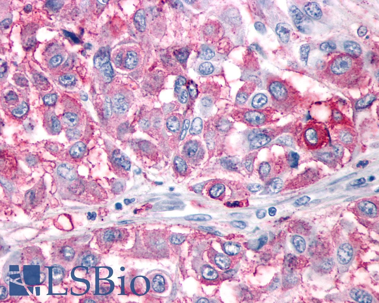 IHC-plus™ Polyclonal Rabbit anti-Human NPY1R Antibody (Cytoplasmic Domain, IHC)