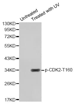 CDK2 Antibody (phospho-Thr160)