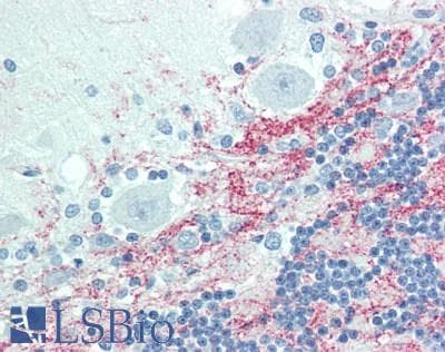 IHC-plus™ Polyclonal Rabbit anti-Human GJB6 / CX30 / Connexin 30 Antibody (IHC)