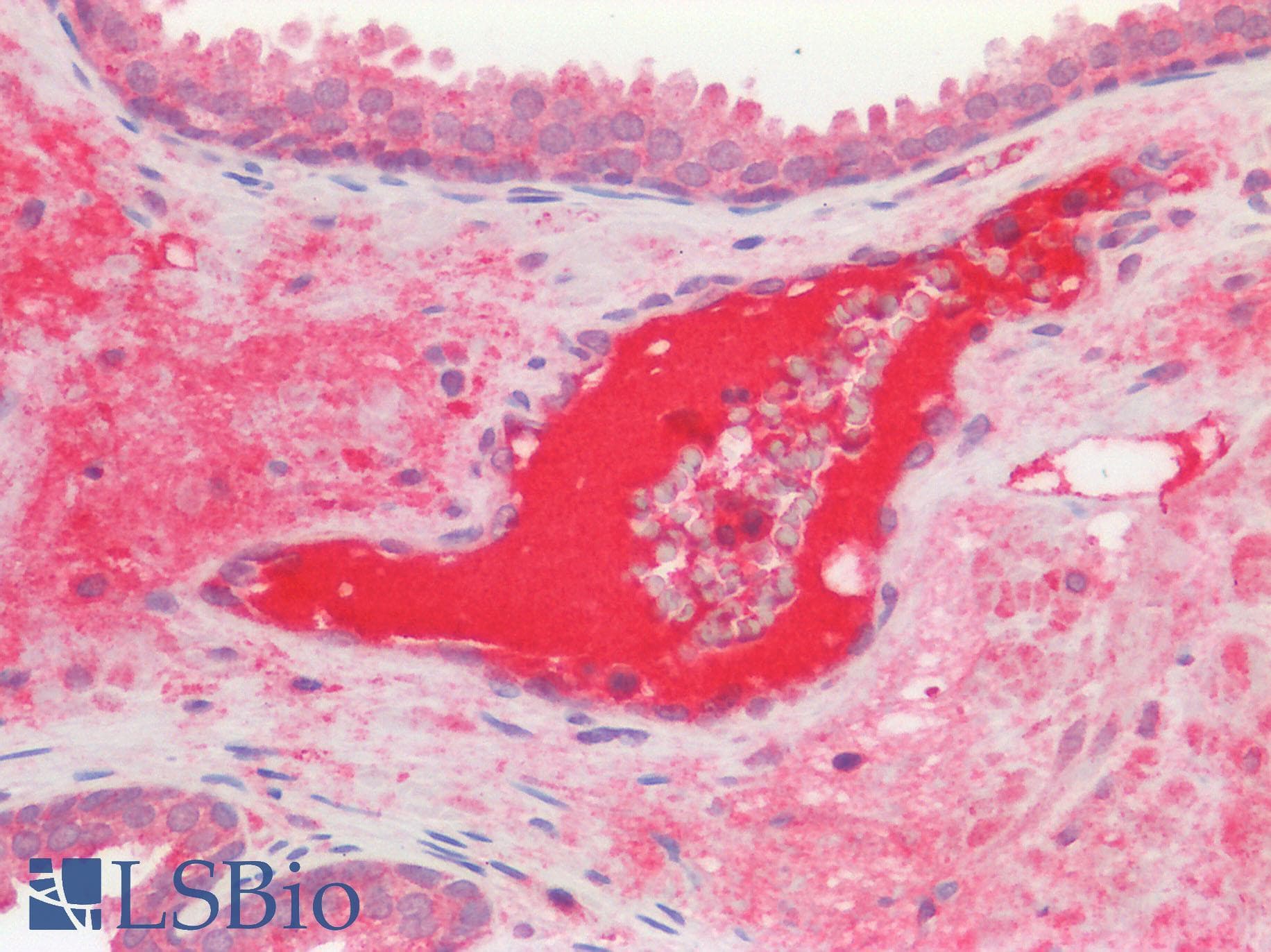 PathPlus™ Polyclonal Rabbit anti-Human GPR49 / LGR5 Antibody (Cytoplasmic Domain, IHC, IF)