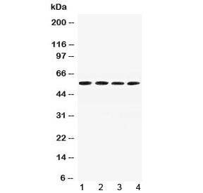 AGT / Angiotensinogen Antibody