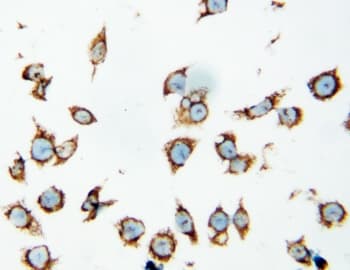 HSPD1 / HSP60 Antibody (aa503-516)