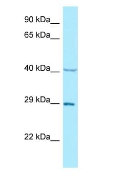 NCK1 / NCK Antibody (aa52-101)