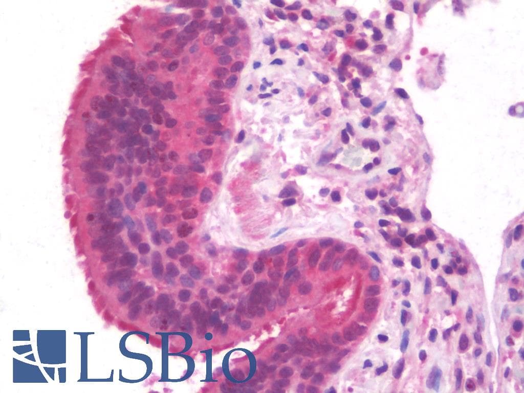 IHC-plus™ FMR1 / FMRP Antibody (clone 1D10)