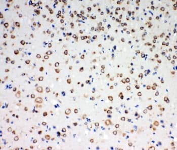 NTRK3 / TRKC Antibody (aa167-182)