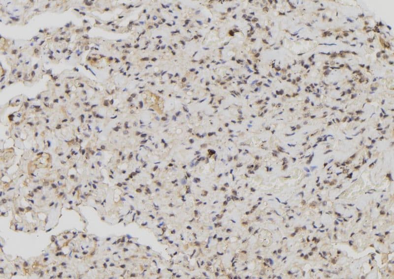 MX1 / MX Antibody