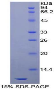 Human BTC / Betacellulin Protein (Recombinant His)