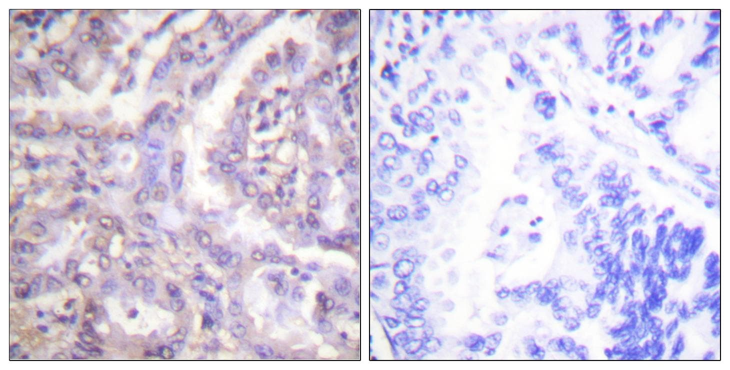 TBC1D4 / AS160 Antibody (phospho-Thr642)