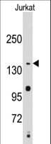 SMC2 Antibody (aa1166-1197)