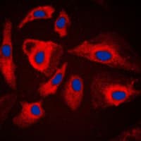 HSPH1 / HSP105 Antibody (C-Terminus)