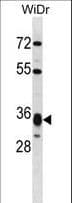 HMGCL Antibody (aa161-190)