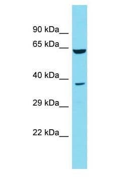 DCDC2B Antibody (aa74-123)