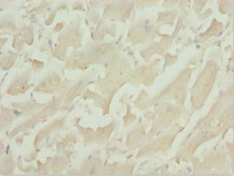 TBPL1 / TRF2 Antibody