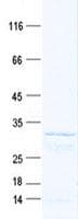 Human SLC25A2 Protein (Recombinant His, N-Terminal)