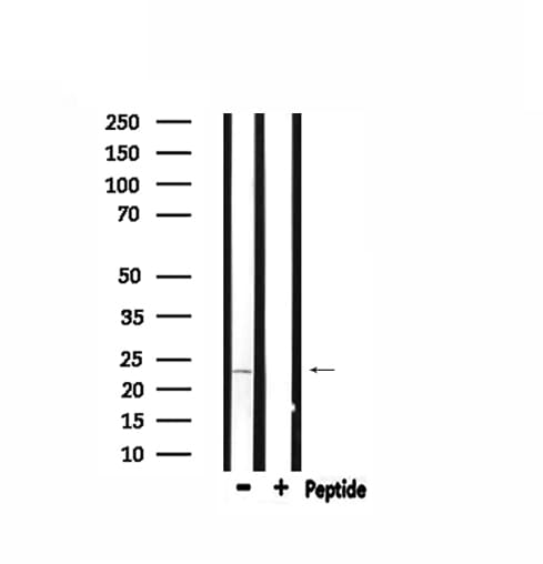 Polyclonal Rabbit anti-Human ARF4 Antibody (IF, WB)