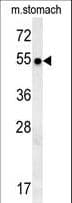 Polyclonal Rabbit anti-Human SPATA18 / MIEAP Antibody (aa92-120, IHC, WB)
