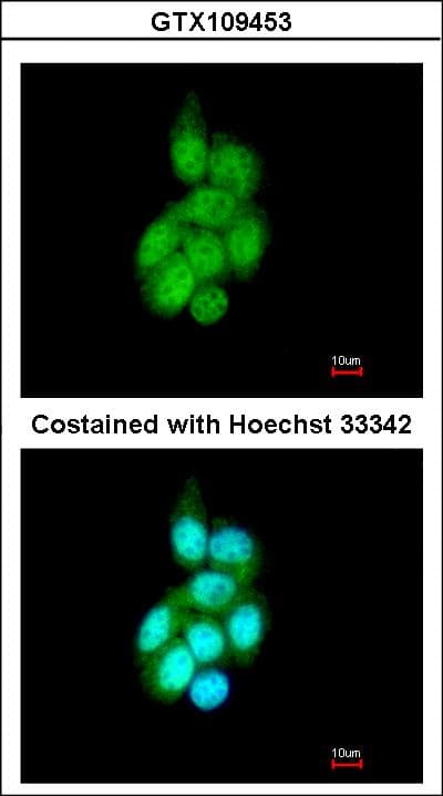 BAIAP2L1 Antibody (aa1-266)