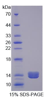 Human PLOD2 Protein (Recombinant His)