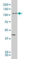 Monoclonal Mouse anti-Human EPHB3 / EPH Receptor B3 Antibody (clone 2G8, IHC, WB)