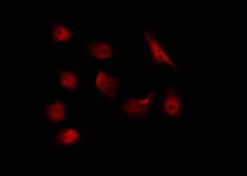 Polyclonal Rabbit anti-Human MAP2K1 / MKK1 / MEK1 Antibody (phospho-Thr291, IF, WB)