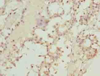 TMEM19 Antibody