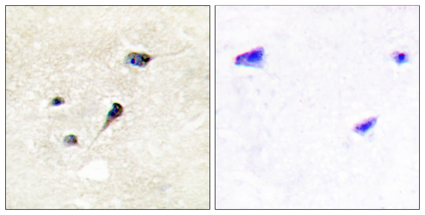 Polyclonal Rabbit anti-Human SYN1 / Synapsin 1 Antibody (phospho-Ser605, IHC, IF)