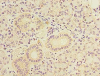 Polyclonal Rabbit anti-Human TBC1D9B Antibody (IHC)