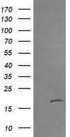 Monoclonal Mouse anti-Human CTAG1B / NY-ESO-1 Antibody (clone OTI9H6, IHC, IF, WB)