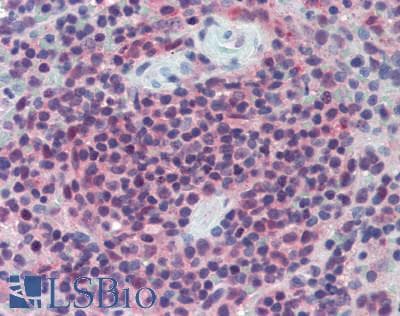 LAG3 Antibody (aa209-451)