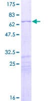 Human HOXD10 Protein (Recombinant GST)