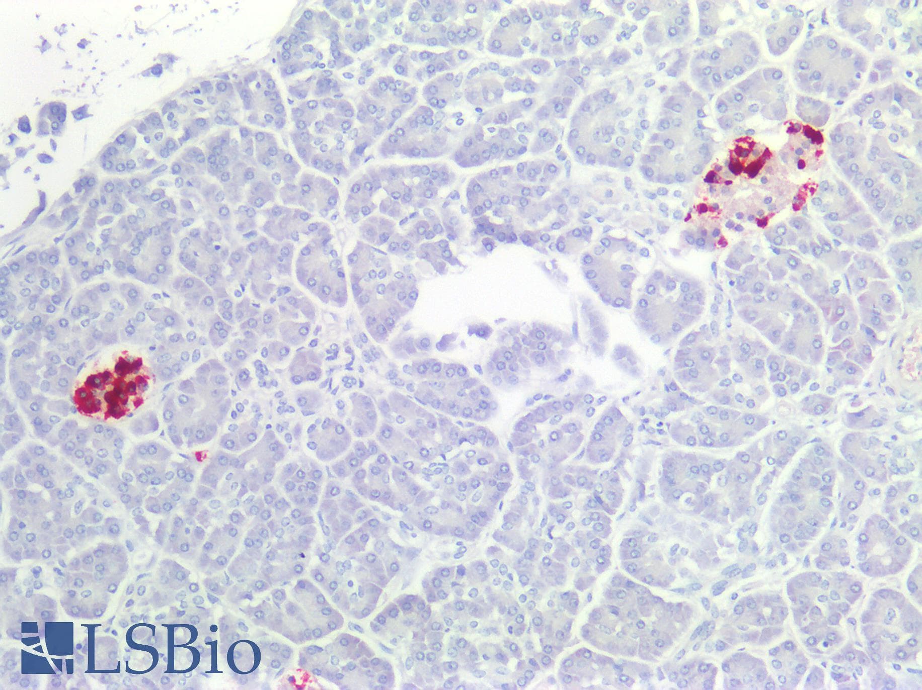 PathPlus™ Monoclonal Mouse anti-Human CHGA / Chromogranin A Antibody (IHC, WB)